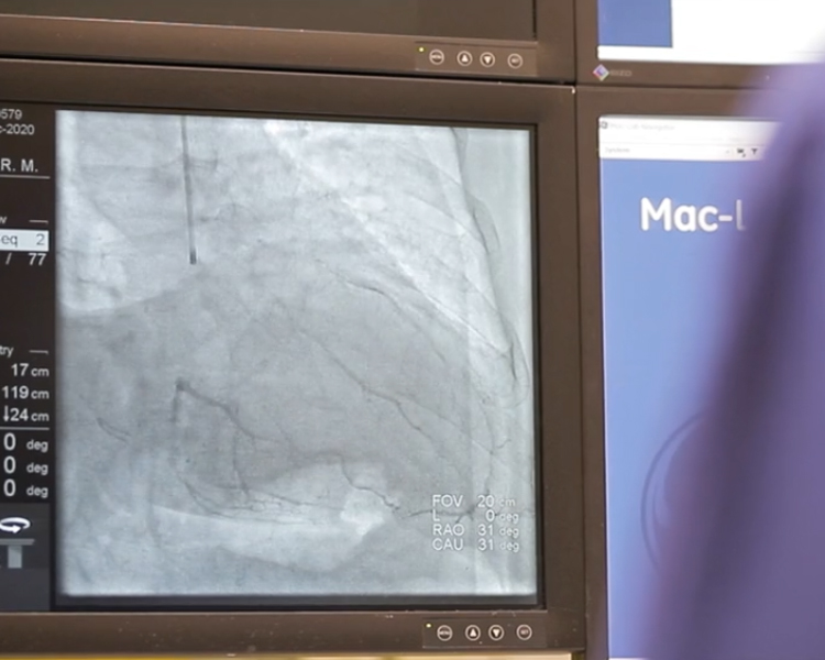 project-slider-image